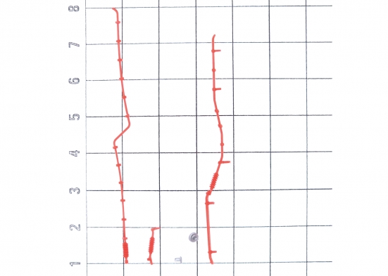 Preview: Märklin E281867 Kamera, Leitungen, Auspuff (Set) Modelleisenbahn